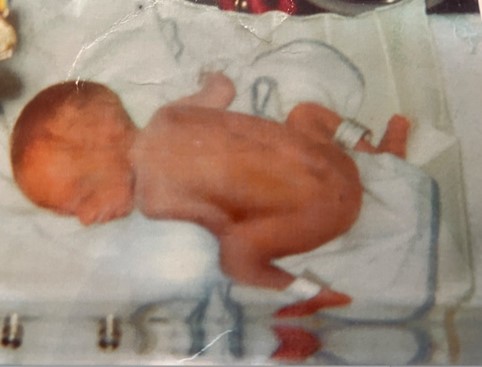 Julian as a premature baby.